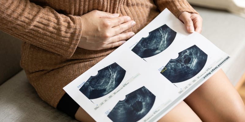 Woman holding an ultrasound report, highlighting diagnostic steps for sudden urinary urgency.